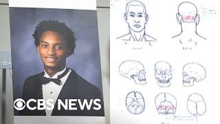 New questions emerge in Nolan Wells' death after family's independent autopsy
