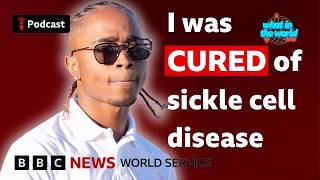 How a $2m treatment cured my sickle cell disease - What in the World podcast, BBC World Service