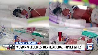 Australian mother naturally conceives identical quadruplets
