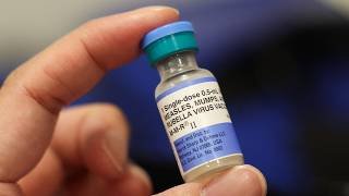 Measles Resurgence Tests US Health System