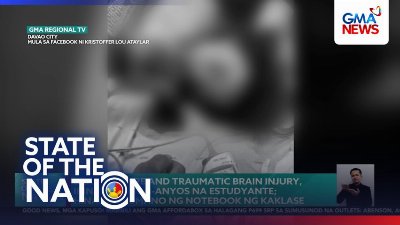 Brain failure and traumatic brain injury, ikinasawi ng 8-anyos na estudyante; hinampas umano ng notebook ng kaklase | SONA